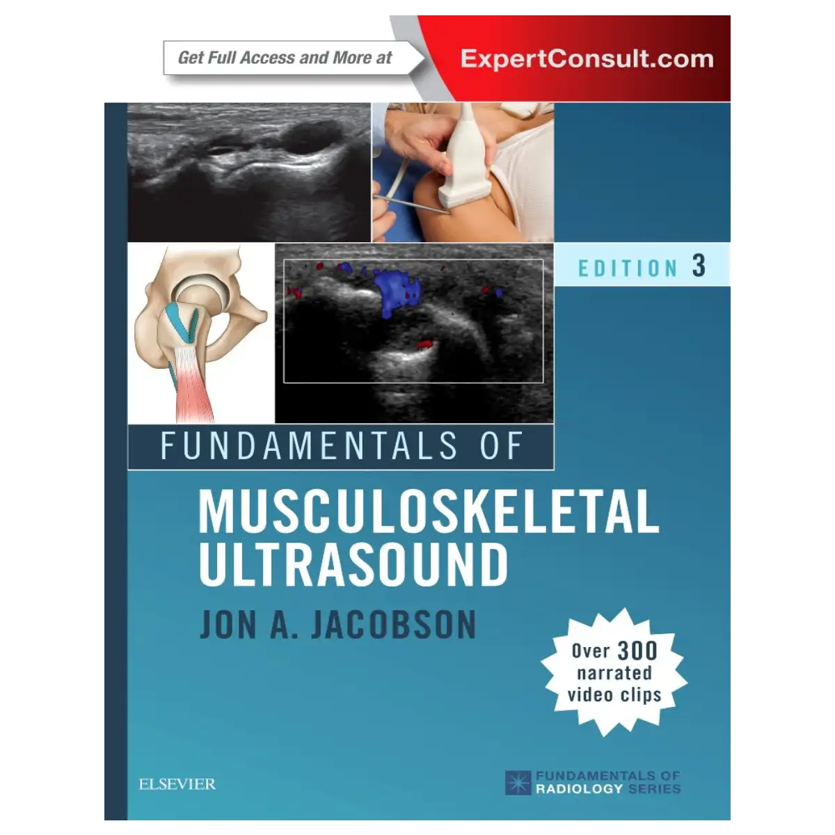 Fundamentals of Musculoskeletal Ultrasound, 3rd Edition - Paperback