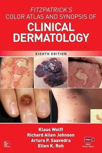 Fitzpatrick's Color Atlas and Synopsis of Clinical Dermatology, 8th Edition