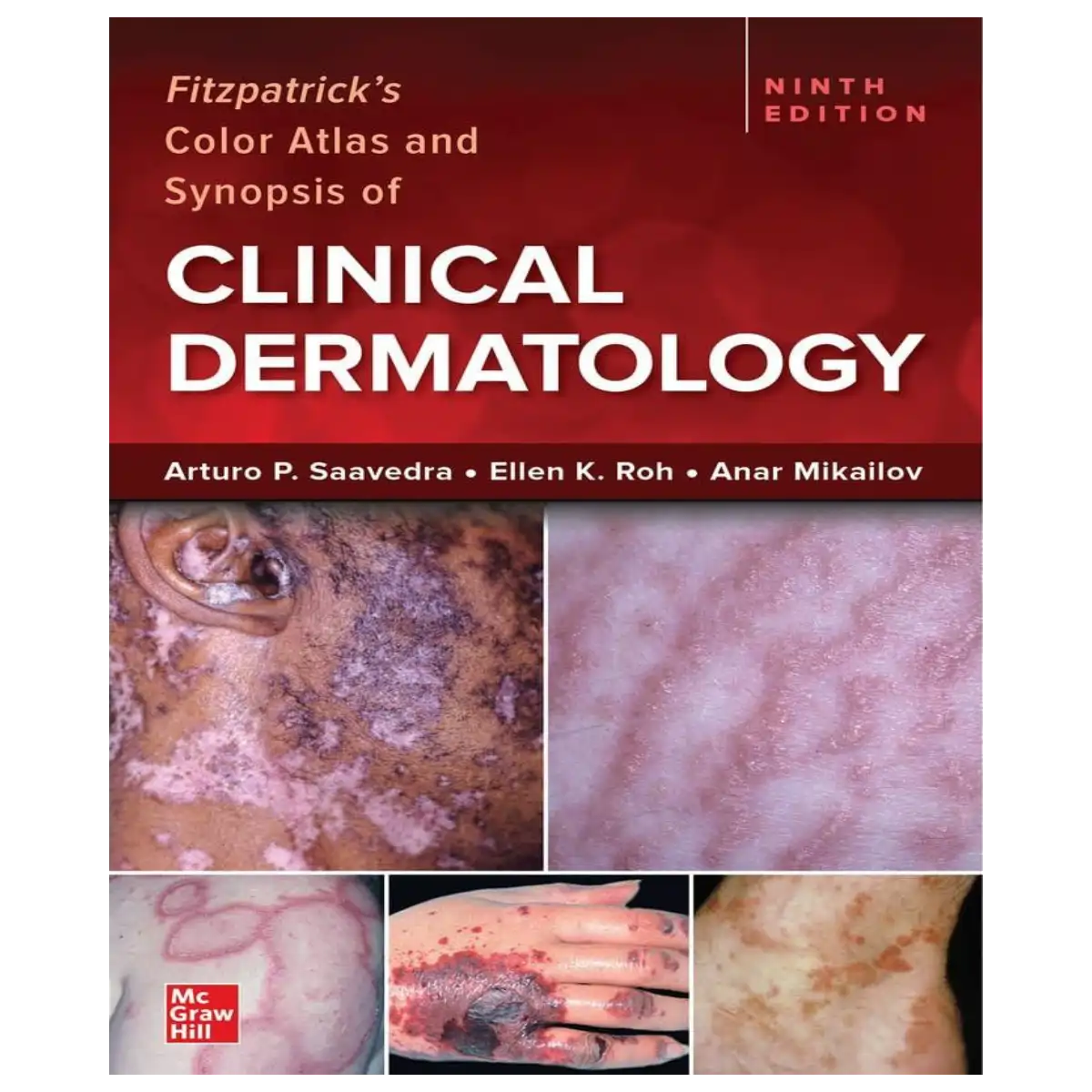 Fitzpatrick's Color Atlas and Synopsis of Clinical Dermatology, Ninth Edition - Paperback